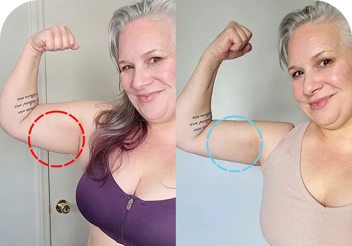 MyoGlow before and after - Atena